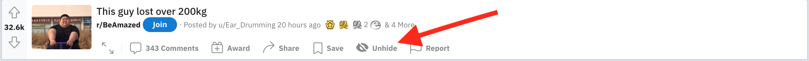 reddit unhide button post